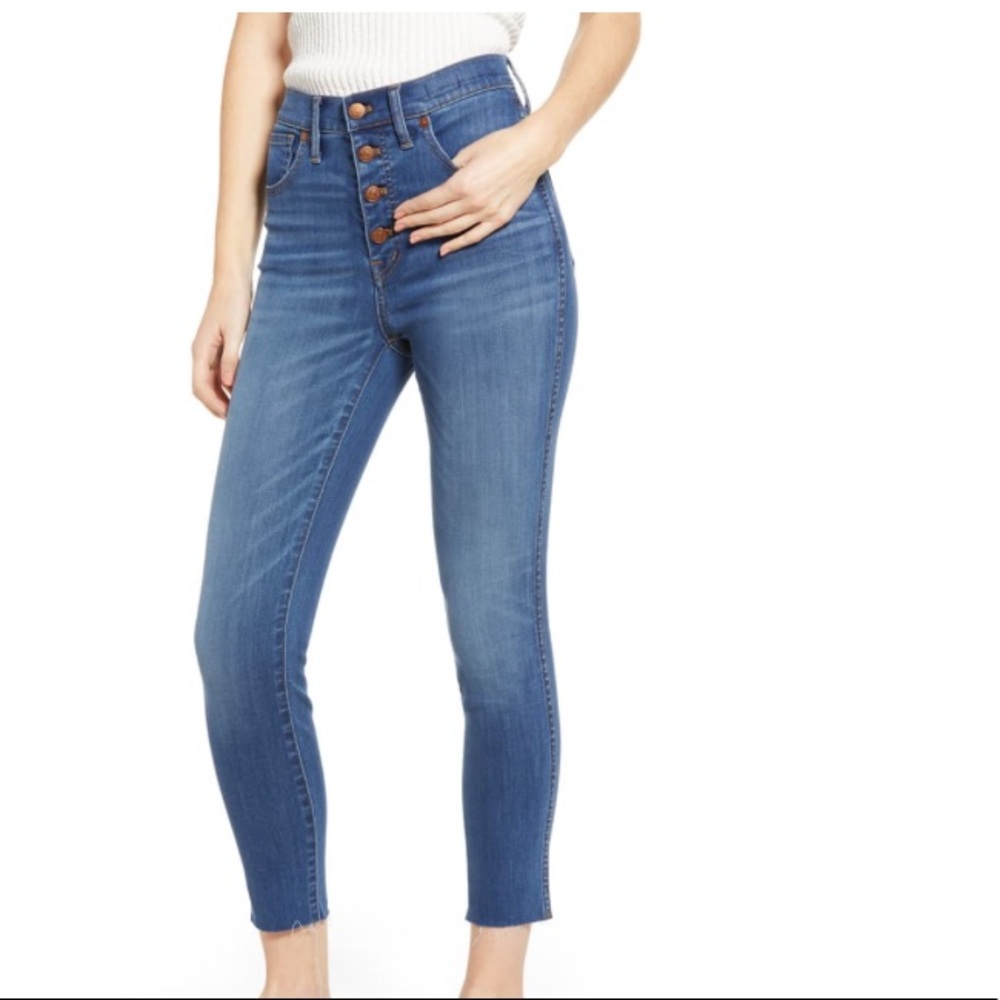 Madewell 10 inch high rise skinny (button front)